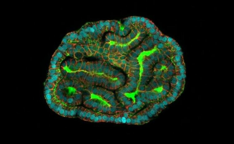 Бъбречните органоиди, генерирани от амниотична течност, показват структури, наподобяващи бъбречни тубули.