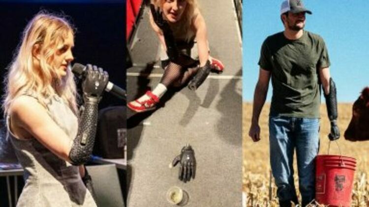 Нова бионична ръка може да се отделя от потребителя и да се движи самостоятелно