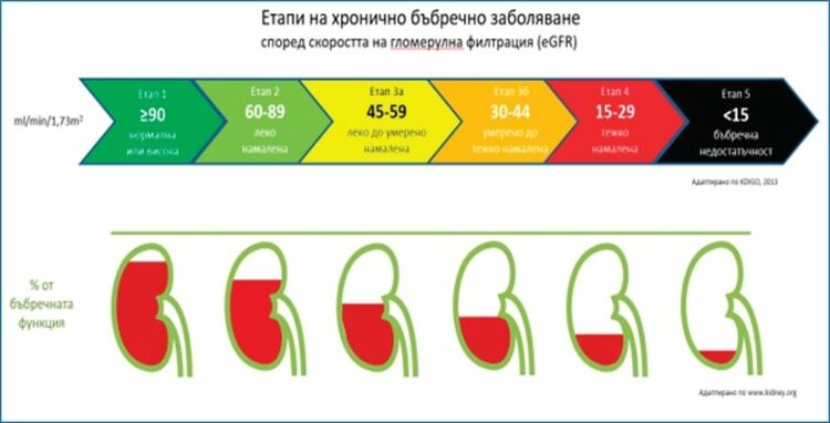 На 7 и 8 юни правят безплатни изследвания за бъбречното здраве в Симеоновград и Тополовград
