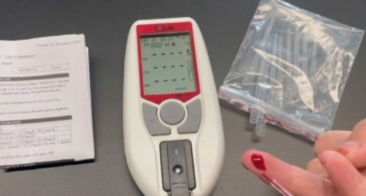 На 14 и 15 юни правят безплатни изследвания за бъбречното здраве в Маджарово и Ивайловград