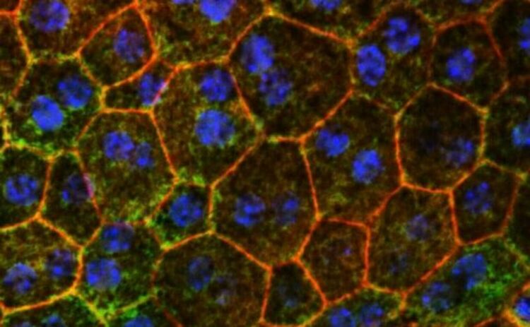 Ново проучване на Медицинския факултет на Вашингтонския университет върху мишки показва, че отстраняването на проблеми с метаболизма на холестерола може да помогне за забавяне или предотвратяване на често срещана причина за свързана с възрастта загуба на зрение. На снимката са показани оцветени в цвят ретинални епителни клетки от око на мишка, първите клетки, които умират с напредването на свързаната с възрастта макулна дегенерация.