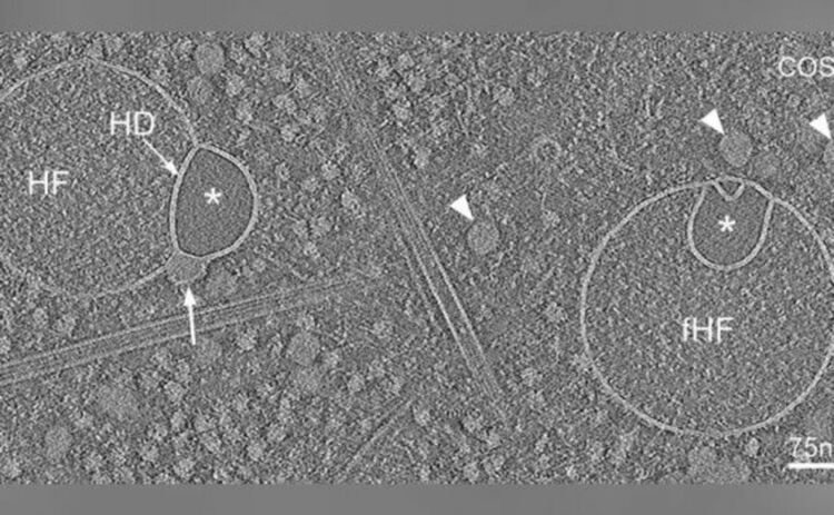 Томографско средно напречно сечение през пряка хемифузома (HF) и обърната хемифузома (fHF), показващо добре дефинирания двуслоен контур на мембраните на везикулите. Единичен двуслоен слой или хемифузионна диафрагма (HD) разделя хемифузираните везикули. По-малката хемифузирана везикула има гладък полупрозрачен лумен (*). Стрелките сочат към протеолипидната частица, както и подобни протеолипидни частици, наблюдавани свободни в цитоплазмата. Мащабна лента: 75 nm.