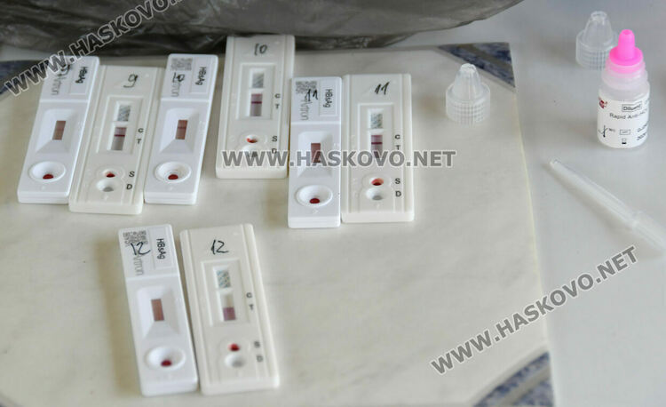 Безплатни изследвания за вирусни хепатити в Хасково