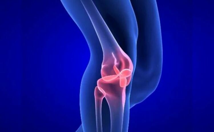 Изкуствен хрущял може да промени коренно третирането на артрита