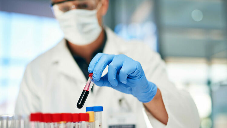 Кръвен тест може да открие над петдесет вида рак?