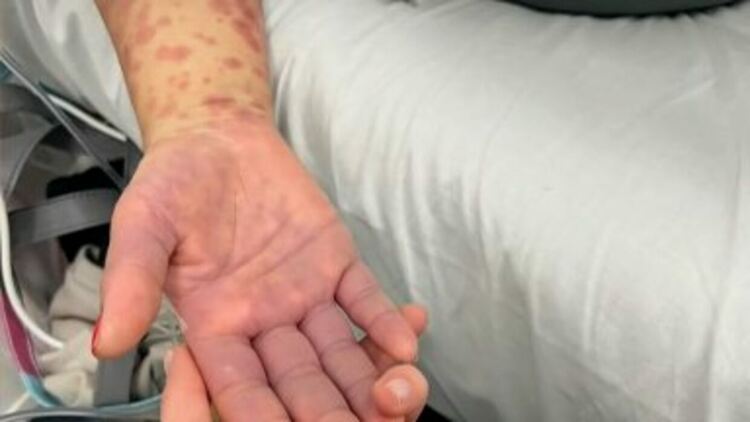 Десетки българки приети в болница, 10 с опасност за живота, след отслабване с хранителна добавка