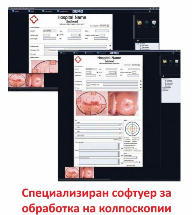 Пловдивският онкогинеколог д-р Андреев – ранната диагноза и лечение на предраковите изменения на маточната шийка спасява живота на пациентките