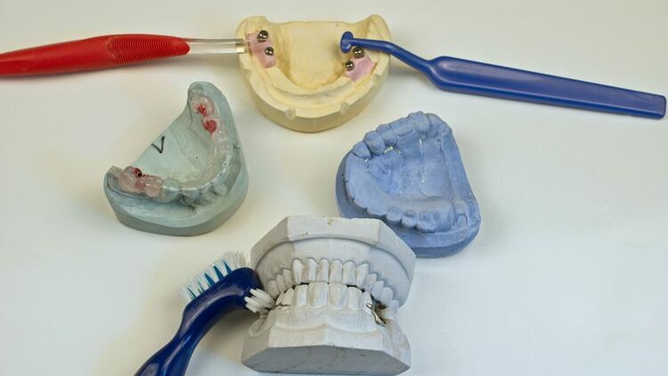 Алцхаймер, диабет и инфаркт. Причината може да е в устата