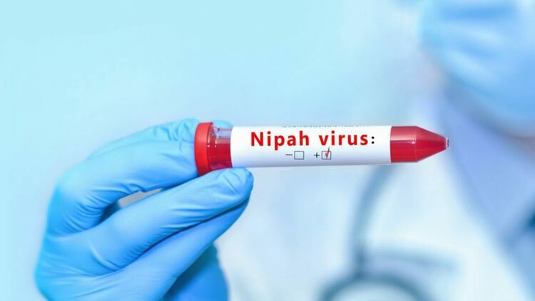 Заразяването с Нипа вирус може да наподобява грип