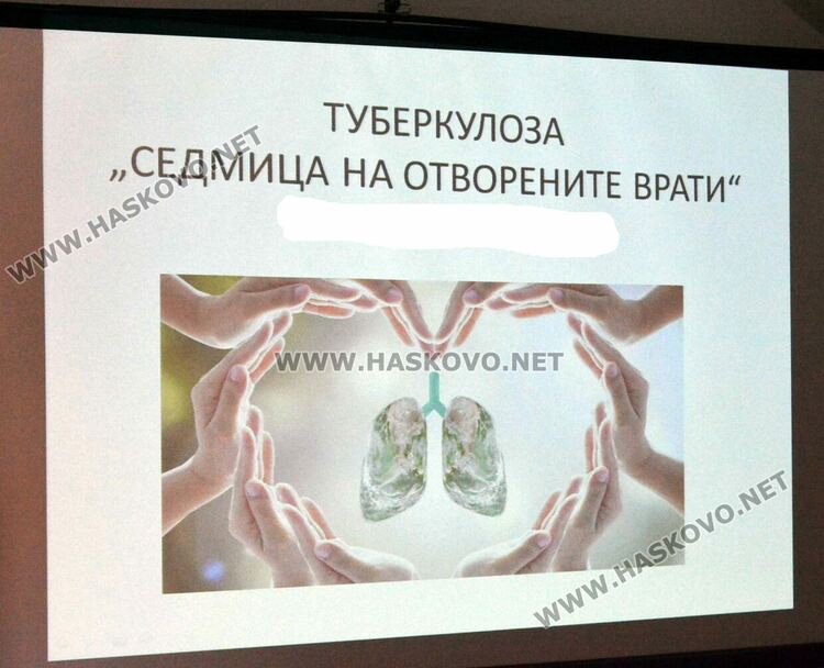 Организират безплатни прегледи за туберкулоза и беседи в Хасково и Димитровград