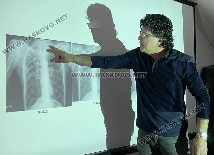 Белодробен лекар: Туберкулозата може да се ограничи с контрол, диагностика и правилно лечение