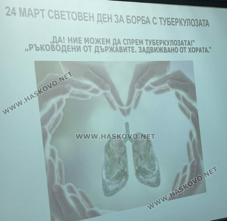 Белодробен лекар: Туберкулозата може да се ограничи с контрол, диагностика и правилно лечение