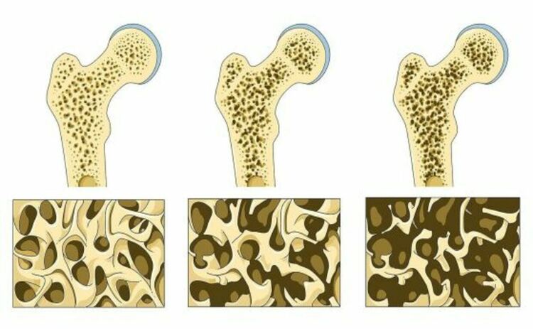 Учени са открили скрит &bdquo;костен превключвател&ldquo;, който може да възстанови и защити костите.