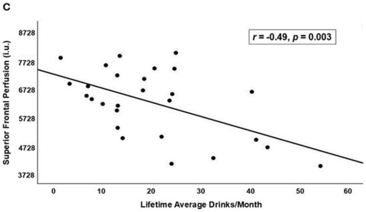 Дори ниските нива на алкохол могат да увредят мозъка ви, установи проучване 